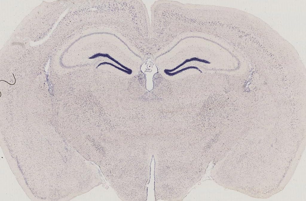 Label Histologie participe à la cartographie de 78 récepteurs orphelins couplés aux protéines G dans le cerveau de souris