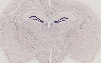 Histologie - récepteur GPR5b