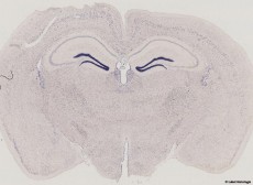 Histologie - récepteur GPR5b